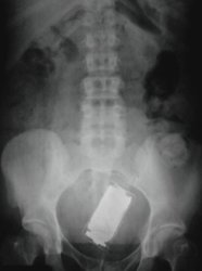 x-ray-book-stuck-up-ipod.jpg