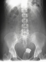 x-ray-objects-stuck-up-butts-1.jpg